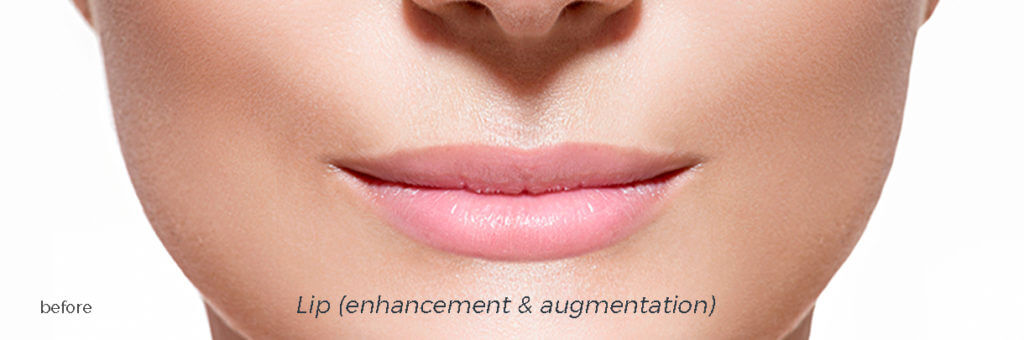 The Smile Workx - Anti Wrinkle Injections Dermal Fillers Before