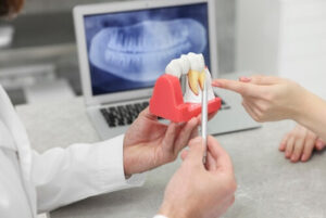 Cost Of Dental Implants In Australia image noosaville