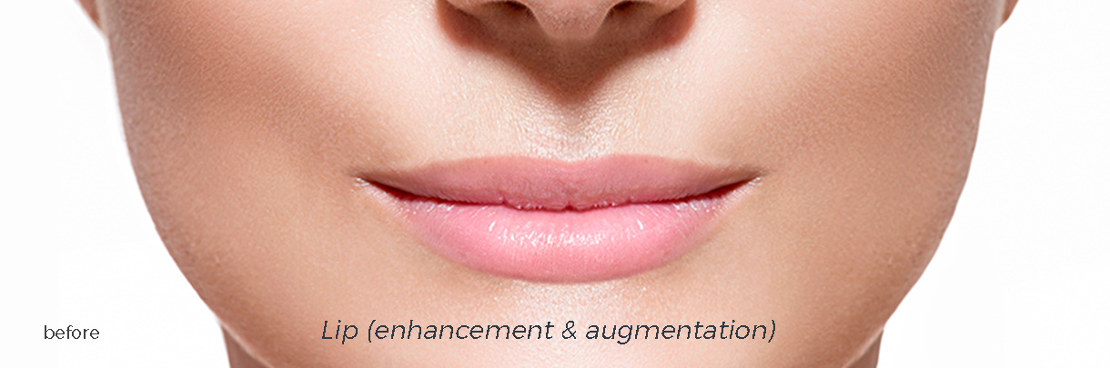 lips without augmentation