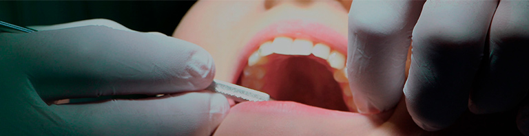 dentist hands working on a pacient