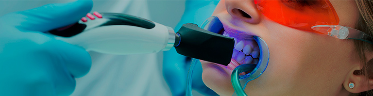 photo of Teeth whitening for Mobile