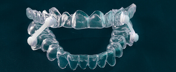 The Smile Workx - Dental Services - TMJ Sleep Apnoea Treatments Anti Snoring Devices