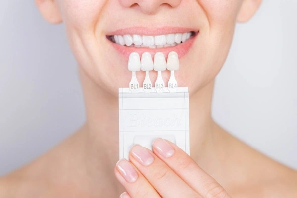 Woman holding dental tooth shade samples