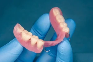 Do Dentures Ever Feel Normal partial