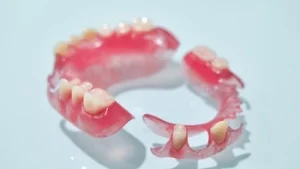 can denture teeth be lengthened preparation